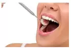 Teeth whitening in GA